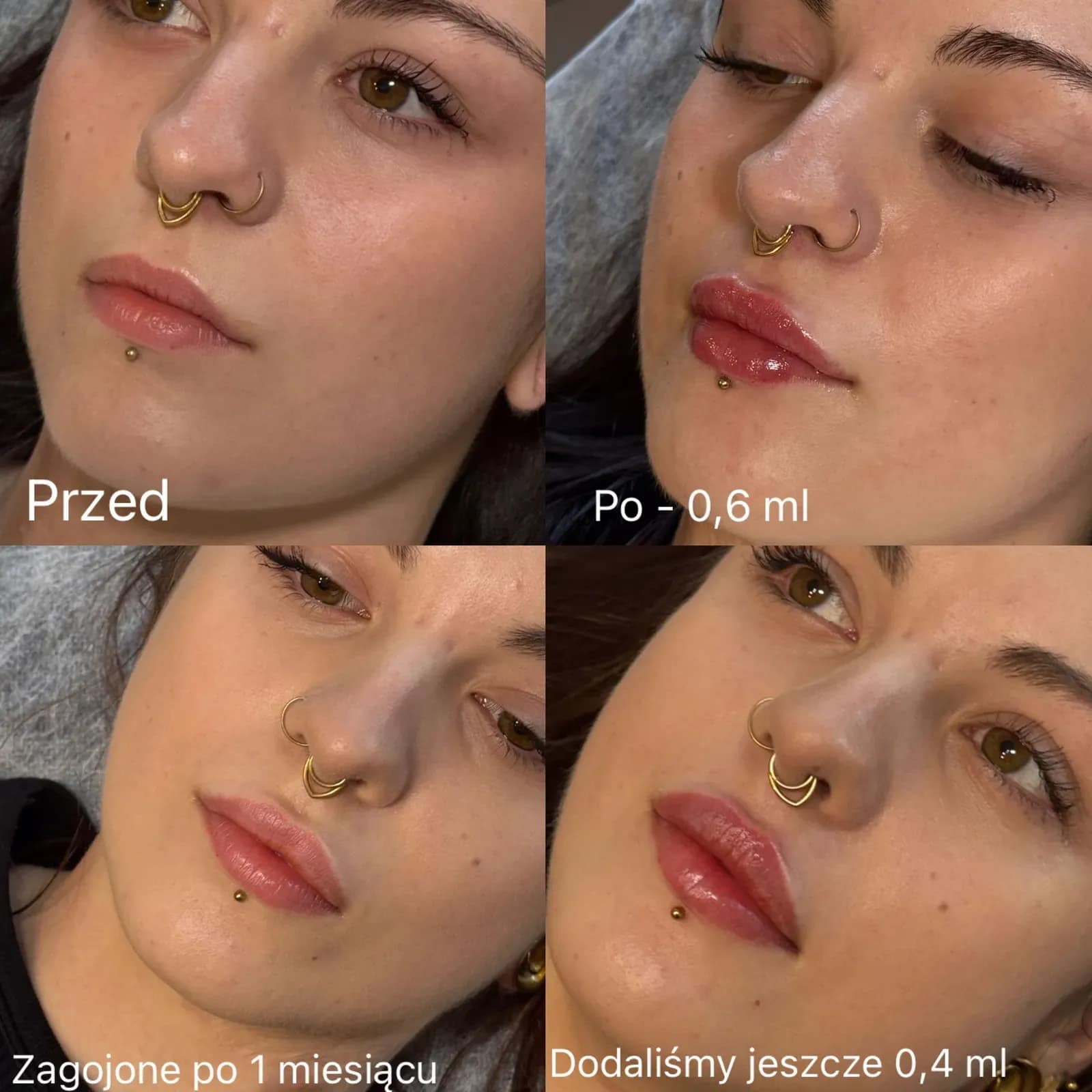 Efekt modelowania ust